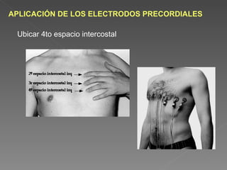 APLICACIÓN DE LOS ELECTRODOS PRECORDIALES

 Ubicar 4to espacio intercostal
 