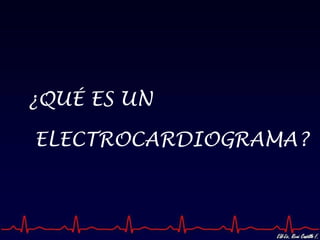 ¿QUÉ ES UN ELECTROCARDIOGRAMA? 