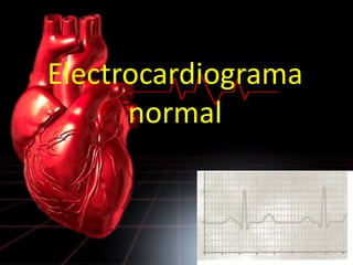 Electrocardiograma
normal
 