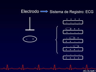 Electrodo   Sistema de Registro: ECG
                     +       +        +        +
                     -       -        -        -
                         -        -        -        -

                     - +              +        +
                     + -              -        -

                     -       - + +
  -   +
                    +        + - -

                     -        -       - +
                    +        +        + -

                    -         -        -        -
                    +        +        +        +
 