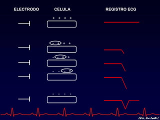 ELECTRODO       CELULA       REGISTRO ECG

            + + + +




            - + + +


            - - + +


            -    -   - +




            -    -   -   -
 