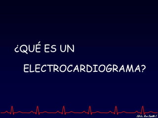 ¿QUÉ ES UN

 ELECTROCARDIOGRAMA?
 