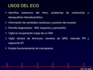 USOS DEL ECG
Identifica   trastornos   del   ritmo,   problemas   de   conducción   y
desequilibrio hidroelectrolítico

Información de cavidades cardiacas y posición del corazón

Permite diagnosticar: IAM, isquemia y pericarditis

Vigila la recuperación luego de un IAM

Vigila efectos de fármacos, cambios de QRS, intervalo PR y
segmento ST

Evalúa funcionamiento de marcapasos
 