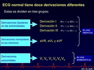 ECG normal tiene doce derivaciones diferentes
  Estas se dividen en tres grupos:


Derivaciones bipolares     Derivación I     BI ( + ) y BD ( - ).
en las extremidades        Derivación II    PI ( + ) y BD ( - ).
                           Derivación III   PI ( + ) y BI ( - ).   PLANO
                                                                   FRONTAL


Derivaciones monopolares
                           aVR, aVL y aVF
en los miembros




Derivaciones                                                   PLANO
precordiales
                           V1 V2 V3 V4 V5 V6                   HORIZONTAL
 