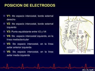 POSICION DE ELECTRODOS

V1: 4to espacio intercostal, borde esternal
derecho
V2: 4to espacio intercostal, borde esternal
izquierdo
V3: Punto equidistante entre V2 y V4
V4: 5to espacio intercostal izquierdo, en la
línea mediaclavicular
V5: 5to espacio intercostal, en la línea
axilar anterior izquierda
V6: 5to espacio intercostal, en la linea
axilar media izquierda
 