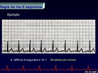 Regla de los 6 segundos

    Ejemplo:




      8 QRS en 6 segundos x 10 =   83 latidos por minuto
 