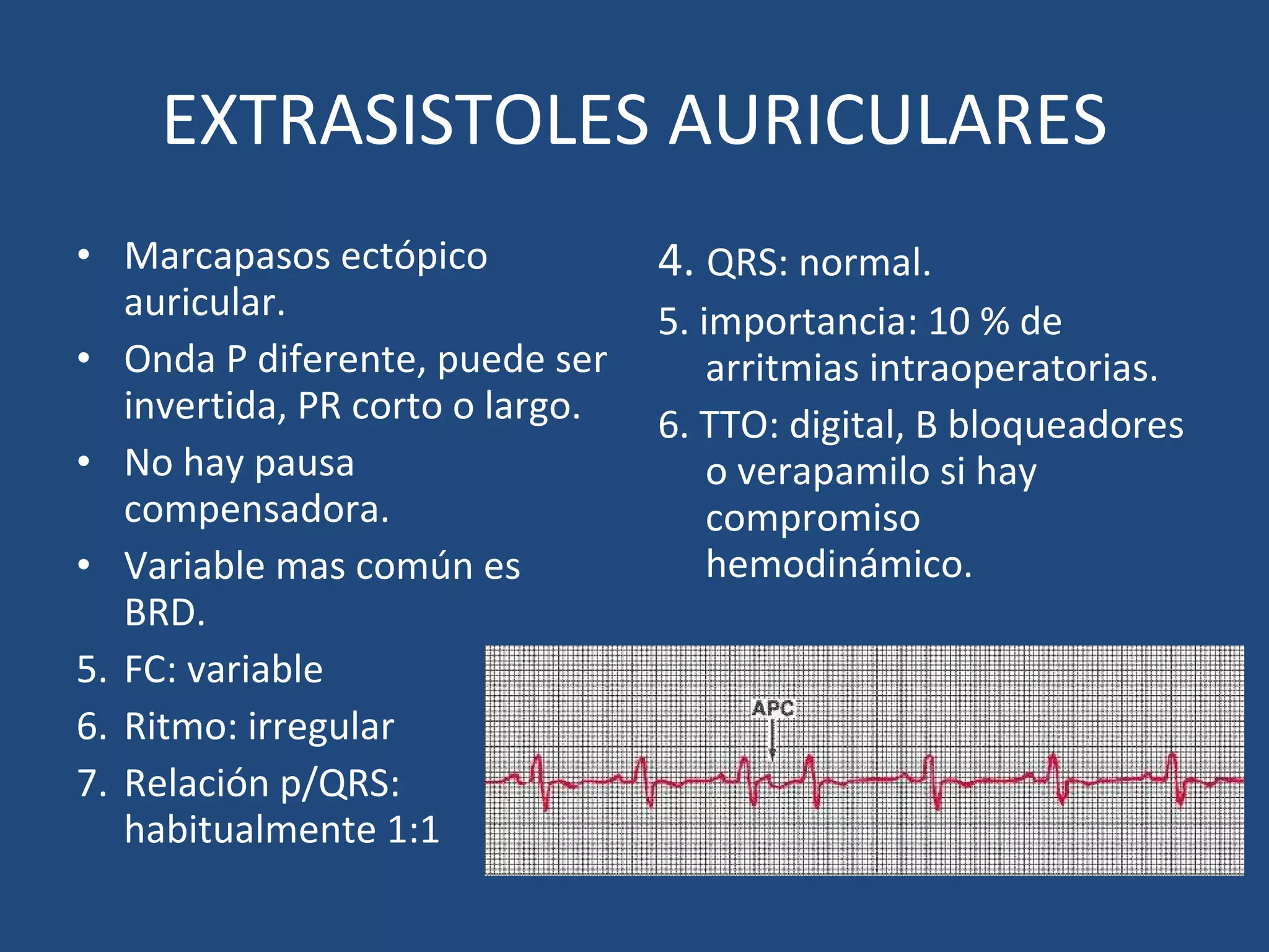 Electrocardiografia intraoperatoria 1 | PPT