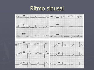ELECTROCARDIOGRAFIA basica normal para estudiantes | PPT