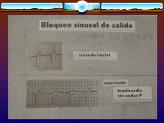 Electrocardiografia practica 2
