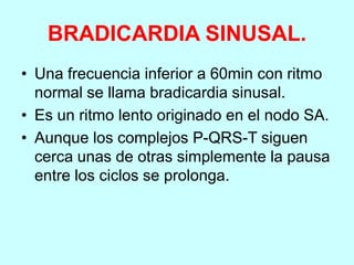 BRADICARDIA SINUSAL.
• Una frecuencia inferior a 60min con ritmo
normal se llama bradicardia sinusal.
• Es un ritmo lento originado en el nodo SA.
• Aunque los complejos P-QRS-T siguen
cerca unas de otras simplemente la pausa
entre los ciclos se prolonga.
 