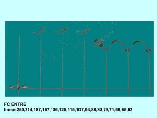 FC ENTRE
lineas250,214,187,167,136,125,115,1O7,94,88,83,79,71,68,65,62
 