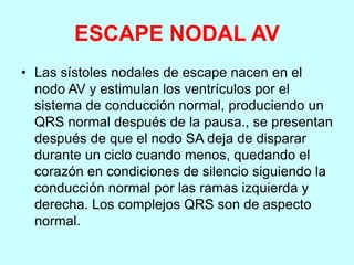 ESCAPE NODAL AV
• Las sístoles nodales de escape nacen en el
nodo AV y estimulan los ventrículos por el
sistema de conducción normal, produciendo un
QRS normal después de la pausa., se presentan
después de que el nodo SA deja de disparar
durante un ciclo cuando menos, quedando el
corazón en condiciones de silencio siguiendo la
conducción normal por las ramas izquierda y
derecha. Los complejos QRS son de aspecto
normal.
 