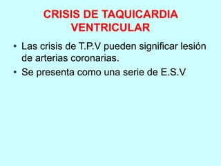 CRISIS DE TAQUICARDIA
VENTRICULAR
• Las crisis de T.P.V pueden significar lesión
de arterias coronarias.
• Se presenta como una serie de E.S.V
 