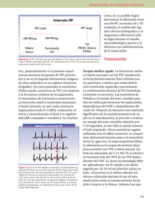 Taquicardias de complejos estrechos

                                                                                            casos, no es posible lograr
                                                                                            determinar la diferencia entre
                                                                                            una RNAV, reentrada AV y TA
                                                                                            mediante el análisis del reg­
                                                                                            istro electro­car­diográfico y el
                                                                                            diagnóstico diferencial sólo
                                                                                            se logra durante el estudio
                                                                                            electro­fisio­ló­gico previo a la
                                                                                            ablación con radiofrecuencia
                                                                                            de la taqui­car­dia.

Algoritmo 4. RP: intervalo que se mide desde el inicio de la onda R hasta el inicio de la   Tratamiento
onda P; RNAV: reentrada nodo AV; TA: taquicardia atrial; PTRU: forma permanente de la
taquicardia reciprocante de la unión.


tico, particularmente si el paciente expe­ri­                          Terapia médica aguda. La frecuencia cardía­
menta síntomas frecuentes de TSV paro­xís­                             ca rápida asociada con las TSV usual­mente
tica y no se ha logrado documentar ninguno                             es hemodiná­mi­ca­mente bien tolerada por
de estos episodios en un registro electro­car­                         los pacientes, a menos que exista disfun­
diográfico. En estos pacientes el monitoreo                            ción ventricular iz­quierda conco­mi­tante.
Holter puede caracterizar la TSV con respecto                          La car­dioversión eléctrica (CVE) inme­diata
a la frecuencia máxima de la taquicardia,                              raramente es necesaria. Las maniobras de
el mecanismo de iniciación y terminación                               Valsalva o el masaje del seno carotídeo pue­
(contracción atrial o ventricular prematura                            den ser útiles para terminar las taqui­car­dias
o latido sinusal), en qué onda termina la                              depen­dientes del NAV o dependientes del
ta­qui­cardia (onda P o QRS), aceleración al                           nodo SA. Des­pués de descartar una estenosis
inicio y desaceleración al final y la regula­ri­                       signi­fi­cativa de la carótida (au­sen­cia de so­
dad (RR constantes o variables). En muchos                             plo en la aus­cultación), se procede a realizar
                                                                       un masaje del seno carotídeo de­re­cho por
                                                                       5-10 segun­dos, si éste falla se puede intentar
                                                                       el lado izquierdo. Otras maniobras vagales
                                                                       utili­za­das son el reflejo nauseoso, la compre­
                                                                       sión abdominal durante pujo y la inmersión
                                                                       facial en agua fría. Si estas manio­bras fallan,
                                                                       la adeno­sina es la terapia de primera línea
                                                                       para convertir una TSV a ritmo sinusal. Un
                                                                       bolo de adenosina de 6-12 MG IV es efectivo
                                                                       en ter­minar más del 90% de las TSV de­pen­
                                                                       dientes del NAV. La dosis recomendada debe
                                                                       ser aplicada por vía IV rápida y sin diluir,
Figura 172. En el primer registro se observa una taquicardia con
intervalo RP largo, en la cual el intervalo RP es mayor que el 50%     seguida por 10-20 ml de solución salina en
de la longitud de ciclo de la taquicardia (intervalo RR). En los dos   bolo. Al paciente se le deben advertir los
registros inferiores se observan taqui­car­dias con intervalo RP
corto en la cual el intervalo RP es menor que el 50% de la lon­        efectos cola­te­rales durante el uso de esta
gitud de ciclo de la taquicardia. El segundo registro corresponde      medicación como el enroje­ci­miento facial,
a un intervalo RP corto, menor de 70 mseg. (RNAV), y el tercer
registro corresponde a un intervalo RP corto, pero mayor de 70         dolor torácico y la disnea. Además hay que
mseg. (Reentrada AV).



                                                                                                                         101
 