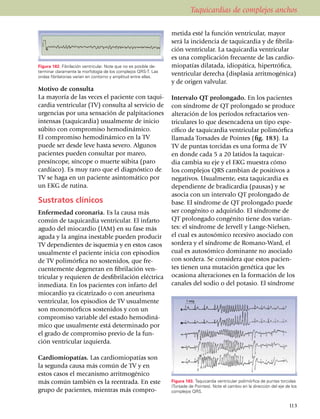 Taquicardias de complejos anchos

                                                                  metida esté la función ventricular, mayor
                                                                  será la incidencia de taquicardia y de fibri­la­
                                                                  ción ventricular. La taquicardia ven­tri­cular
                                                                  es una complicación frecuente de las car­dio­
Figura 182. Fibrilación ventricular. Note que no es posible de­   mio­pa­tías dilatada, idiopática, hiper­trófica,
terminar claramente la morfología de los complejos QRS-T. Las
ondas fibrilatorias varían en contorno y amplitud entre ellas.
                                                                  ventri­cular de­recha (displasia arritmogénica)
                                                                  y de origen valvular.
Motivo de consulta
La mayoría de las veces el paciente con ta­qui­                   Intervalo QT prolongado. En los pacientes
cardia ventricular (TV) consulta al servicio de                   con síndrome de QT prolongado se produce
urgencias por una sensación de palpitaciones                      alteración de los períodos refrac­tarios ven­
intensas (taquicardia) usual­mente de inicio                      tri­culares lo que desencadena un tipo espe­
súbito con compromiso hemodinámico.                               cí­fico de taqui­cardia ventricular polimórfica
El compromiso hemodiná­mico en la TV                              llamada Torsades de Pointes (fig. 183). La
puede ser desde leve hasta severo. Algunos                        TV de puntas torcidas es una forma de TV
pa­cientes pueden consultar por mareo,                            en donde cada 5 a 20 latidos la taquicar­
presíncope, síncope o muerte súbita (paro                         dia cambia su eje y el EKG muestra cómo
cardíaco). Es muy raro que el diagnóstico de                      los complejos QRS cambian de positivos a
TV se haga en un paciente asinto­má­tico por                      negativos. Usual­mente, esta taquicardia es
un EKG de rutina.                                                 dependiente de bradicardia (pausas) y se
                                                                  asocia con un intervalo QT prolongado de
Sustratos clínicos                                                base. El síndrome de QT pro­longado puede
Enfermedad coronaria. Es la causa más                             ser congé­nito o adquirido. El síndrome de
común de taqui­car­dia ventricular. El infarto                    QT prolongado congénito tiene dos varian­
agudo del miocardio (IAM) en su fase más                          tes: el síndrome de Jervell y Lange-Nielsen,
aguda y la angina inestable pueden producir                       el cual es autosómico recesivo aso­cia­do con
TV depen­dientes de isquemia y en estos ca­sos                    sordera y el sín­dro­me de Romano-Ward, el
usualmente el paciente inicia con episodios                       cual es auto­­sómico domi­nante no asociado
de TV polimórfica no sostenidos, que fre­                         con sordera. Se con­si­dera que estos pacien­
cuen­­temente degeneran en fibrilación ven­                       tes tienen una mu­­tación genética que les
tricular y re­quie­ren de des­fibrilación eléctrica               oca­­siona alteraciones en la formación de los
inmediata. En los pacientes con infarto del                       canales del sodio o del potasio. El sín­dro­me
miocardio ya cicatri­zado o con aneurisma
ventricular, los episo­dios de TV usual­mente
son monomórficos sostenidos y con un
compro­miso variable del estado hemodi­ná­
mico que usual­men­te está deter­minado por
el grado de compromiso previo de la fun­
ción ventricular izquierda.

Cardiomiopatías. Las cardio­miopatías son
la segunda causa más común de TV y en
estos casos el mecanismo arritmo­gé­nico
más común también es la reentrada. En este                        Figura 183. Taquicardia ventricular polimórfica de puntas torcidas
                                                                  (Torsade de Pointes). Note el cambio en la dirección del eje de los
gru­po de pacientes, mientras más compro­                         complejos QRS.


                                                                                                                                113
 