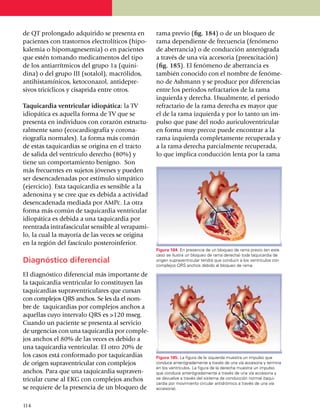 de QT prolongado adqui­ri­do se pre­senta en         rama previo (fig. 184) o de un blo­queo de
pacientes con trastornos electrolíticos (hipo­       rama depen­diente de frecuencia (fenó­me­no
kalemia o hipomagnesemia) o en pacientes             de aberrancia) o de con­ducción anterógrada
que estén toman­do medica­mentos del tipo            a través de una vía acce­soria (preexci­ta­ción)
de los antiarrítmicos del grupo 1a (quini­           (fig. 185). El fenómeno de aberrancia es
dina) o del grupo III (sotalol), macrólidos,         también cono­cido con el nombre de fenó­me­
antihista­mínicos, keto­conazol, antide­pre­         no de Ashmann y se produce por dife­ren­cias
sivos tricíclicos y cisaprida entre otros.           entre los pe­río­dos refractarios de la rama
                                                     izquier­da y derecha. Usual­men­te, el período
Taquicardia ventricular idiopática: la TV            refrac­tario de la rama derecha es mayor que
idiopática es aquella forma de TV que se             el de la rama iz­quierda y por lo tanto un im­
presenta en individuos con corazón estructu­         pulso que pase del nodo auriculoventricular
ralmente sano (ecocardiografía y corona­             en forma muy precoz puede encontrar a la
rio­grafía normales). La forma más común             rama izquierda comple­ta­mente recupe­ra­da y
de estas taquicardias se origina en el tracto        a la rama derecha parcialmente recu­pe­rada,
de salida del ventrículo derecho (80%) y             lo que implica conducción lenta por la rama
tiene un compor­ta­miento benigno. Son
más frecuentes en sujetos jóvenes y pueden
ser desencadenadas por estímulo simpático
(ejercicio). Esta ta­qui­cardia es sensible a la
adenosina y se cree que es debida a acti­vi­dad
desen­ca­de­nada mediada por AMPc. La otra
forma más común de taquicardia ventricular
idiopá­tica es debida a una taqui­cardia por
reentrada intra­fascicular sensible al vera­pa­mi­
lo, la cual la mayoría de las veces se ori­gina
en la región del fascículo poste­ro­in­ferior.
                                                     Figura 184. En presencia de un bloqueo de rama previo (en este
                                                     caso se ilustra un bloqueo de rama derecha) toda taquicardia de
Diagnóstico diferencial                              origen supraventricular tendrá que conducir a los ventrículos con
                                                     complejos QRS anchos debido al bloqueo de rama.

El diagnóstico diferencial más importante de
la taquicardia ventricular lo constituyen las
taquicardias supraventriculares que cursan
con complejos QRS anchos. Se les da el nom­
bre de taqui­cardias por complejos anchos a
aquellas cuyo inter­valo QRS es >120 mseg.
Cuan­do un paciente se pre­sen­ta al servicio
de urgen­cias con una taquicardia por comple­
jos anchos el 80% de las veces es debido a
una taquicardia ven­tri­cular. El otro 20% de
los casos está conformado por taqui­car­dias         Figura 185. La figura de la izquierda muestra un impulso que
de origen supra­ventricular con complejos            conduce anterógradamente a través de una vía accesoria y ter­mina
                                                     en los ventrículos. La figura de la derecha muestra un impulso
an­chos. Para que una taqui­car­dia supra­ven­       que conduce anterógradamente a través de una vía accesoria y
tri­cular curse al EKG con complejos anchos          se devuelve a través del sistema de conducción normal (taqui­
                                                     car­dia por movimiento circular antidrómico a través de una vía
se requiere de la presencia de un bloqueo de         accesoria).



1
	 14
 