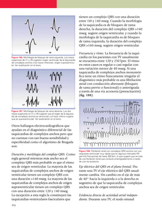tienen un complejo QRS con una dura­ción
                                                                       entre 110 y 140 mseg. Cuando la morfología
                                                                       de la ta­qui­cardia es de bloqueo de rama
                                                                       derecha, la duración del complejo QRS >140
                                                                       mseg. sugiere origen ventricular, y cuando la
                                                                       mor­fología de la taquicardia es de bloqueo
                                                                       de rama izquierda, la duración del complejo
                                                                       QRS >160 mseg. sugiere origen ventricular.

                                                                       Frecuencia y ritmo. La frecuencia de la taqui­
Figura 186. Morfología de bloqueo de rama izquierda. Los trazos        cardia en los pacien­tes con TV usualmente
superiores de V1 y V6 sugieren origen ventricular de la taquicardia
de complejos anchos y los trazos inferiores, origen supraventricu­
                                                                       se encuentra entre 120 y 250 lpm. El ritmo
lar. Ver expilicación en el texto.                                     en estos casos es regular o casi regular con
                                                                       una variación menor de 40 mseg. Si una
                                                                       taqui­cardia de complejos anchos monomór­
                                                                       fica tiene un ritmo francamente irregular el
                                                                       diag­­nós­tico más probable es una fibrilación
                                                                       atrial con conducción aberrante (bloqueo
                                                                       de rama previo o funcional) o anterógrada
                                                                       a través de una vía accesoria (preexci­tación)
                                                                       (fig. 188).



Figura 187. Morfología de bloqueo de rama derecha. Los dos
trazos superiores en V1 y V6 sugieren que el origen de la taqui­car­
dia de complejos anchos es ven­tricular y el trazo inferior sugiere
que es supraventricular. Ver expilicación en el texto.


Otros hallazgos electrocar­dio­gráficos que
ayudan en el diagnóstico diferencial de las
taquicardias de complejos anchos pero que
no cuentan con tan buena sensibilidad y
especificidad como el algo­rit­mo de Brugada
son:
                                                                       Figura 188. Fibrilación atrial con comple­jos QRS anchos con una
Duración y morfología del complejo QRS. Como                           respuesta ventricular muy rápida que en algunos intervalos RR
                                                                       permite frecuencias de hasta 300 lpm, lo que sugiere que se trata
regla general mientras más ancho sea el                                de una fibrilación atrial que conduce anterógradamente a través
                                                                       de una vía accesoria.
complejo QRS más probable es que el ritmo
sea de origen ventricular. La mayoría de las                           Eje eléctrico del QRS en el plano frontal. Du­
taqui­cardias de complejos anchos de origen                            rante una TV el eje eléctrico del QRS usual­
ventricular tienen un complejo QRS con                                 mente cambia. Un cambio en el eje de más
una duración >140 mseg. La mayoría de las                              de 40° hacia la izquierda o a la derecha es
ta­qui­cardias de complejos anchos de origen                           sugestivo de que la taquicardia de complejos
su­­pra­ventricular tienen un complejo QRS                             anchos sea de origen ventricular.
con una du­ra­ción entre 120 y 140 mseg.
La excepción a esta regla la cons­ti­tuyen las                         Evidencia directa de actividad atrial inde­pen­
taquicardias ventri­cu­lares fasciculares que                          diente. Durante una TV, el nodo sinusal
1
	 16
 
