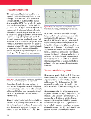Trastornos del calcio
Hipercalcemia. El principal cambio de la
hipercalcemia es la disminución en el inter­
valo QTc. Esta disminución es a expensas
del segmento ST, el cual se acorta o incluso
desa­­­pa­rece (fig. 195). Con niveles de calcio
ma­yo­res de 16 mg/100 mL ocurre prolon­
                                                                   Figura 196. ECG de un individuo con hipocalcemia. Note la
gación de la onda T y el intervalo QT se hace                      prolongación del intervalo QTc a expensas del aumento en la
más nor­mal. El efecto de la hipercalcemia                         duración del segmento ST. La duración de la onda T es normal.

sobre el complejo QRS puede ser va­ria­ble y
                                                                   Es la forma iónica del calcio en la san­gre
se ha descrito que puede cursar sin variación
                                                                   la que es electrofisiológicamente activa. Esta
o con una leve pro­­lon­gación. Un nivel alto
                                                                   prolongación del segmen­to QTc rara vez
de cal­cio usualmente no altera la onda P ni
                                                                   excede el 140% de lo normal. Sola­mente la
la onda T, pero sí aumenta la amplitud de la
                                                                   hipo­calcemia y la hipotermia pro­­­du­cen pro­
onda U. Las arrit­mias car­día­cas son poco co­
                                                                   longación del segmento QTc sin cambios en
munes en la hiper­cal­ce­mia. Oca­sional­mente
                                                                   la duración de la onda T. La hipocalcemia se
se observa una leve prolon­ga­ción del in­
                                                                   acompaña de cambios en la morfología de
tervalo PR y se han reportado algunos casos
                                                                   la onda T (pi­cu­das, aplanadas o inver­ti­das).
de bloqueo AV de segundo o tercer grado.
                                                                   Aunque la hipo­ca­lcemia puede disminuir la
                                                                   duración del in­ter­valo QRS, usualmente es
                                                                   un efecto mínimo. Las ondas P, el inter­valo
                                                                   PR y las ondas U no se afectan por la hipo­
                                                                   calcemia y las arritmias cardíacas son poco
                                                                   comunes.

                                                                   Trastornos del magnesio

                                                                   Hipermagnesemia. El efecto de la hiper­mag­
                                                                   nesemia es difícil de ser detectado en el ECG.
Figura 195. ECG de un individuo con hipercalcemia. Note el acor­   Algunos autores han reportado aumento
tamiento del intervalo QTc a expensas del segmento ST.
                                                                   del inter­valo PR y de la duración del QRS y
Otros tipos de arritmias, que incluyen el                          ocasio­nal­mente blo­queo sinoatrial y blo­
paro sinusal, bloqueo sinoatrial, complejos                        queo AV cuando se admi­nistra mag­ne­sio IV.
prematuros, taquicardia ventricular y muerte
súbita, también han sido reportadas. Usual­                        Hipomagnesemia. En la hipomagnesemia
mente no se producen cambios sobre el                              se puede observar un ligero acorta­mien­to del
intervalo QTc.                                                     intervalo QRS y ondas T con intervalo QTc
                                                                   normal. En la deficiencia crónica de mag­
Hipocalcemia. El principal efecto de la hipo­                      nesio el ECG semeja al de la hipokalemia
calcemia es la prolongación del inter­va­lo QTc.                   (depresión del segmento ST, aplanamiento
Esta prolongación es el resu­l­ta­do de un au­men­­to              de la onda T y algunas veces ligera prolon­ga­
en la dura­ción del segmento ST ya que no                          ción del intervalo PR y del QRS). También se
cambia la duración de la onda T (fig. 196).                        pueden observar ondas U pro­mi­nentes.


1
	 26
 