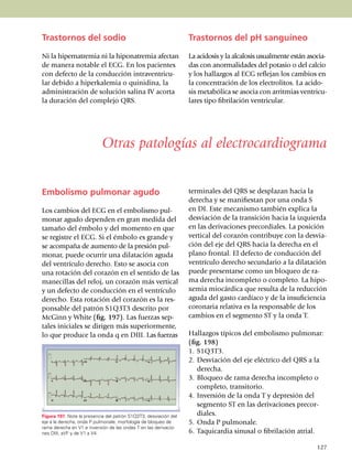 Trastornos del sodio                                              Trastornos del pH sanguíneo

Ni la hipernatremia ni la hipo­natremia afectan                   La acidosis y la alcalosis usual­mente están aso­cia­
de ma­ne­ra notable el ECG. En los pa­­cien­tes                   das con anormalidades del potasio o del cal­cio
con defecto de la con­duc­ción intraventricu­                     y los hallazgos al ECG reflejan los cambios en
lar debido a hiper­­kalemia o quinidina, la                       la concentración de los elec­tro­li­tos. La acido­
admi­nis­tración de solución salina IV acorta                     sis metabólica se asocia con arritmias ven­tri­cu­
la duración del complejo QRS.                                     lares tipo fibrilación ventricular.




                            Otras patologías al electrocardiograma


Embolismo pulmonar agudo                                          terminales del QRS se desplazan hacia la
                                                                  derecha y se manifiestan por una onda S
Los cambios del ECG en el embolismo pul­                          en DI. Este mecanismo también explica la
monar agudo de­penden en gran medida del                          des­viación de la transición hacia la izquierda
tamaño del émbolo y del momento en que                            en las derivaciones precordiales. La posición
se registre el ECG. Si el émbolo es grande y                      ver­tical del corazón contribuye con la des­via­
se acompaña de aumento de la presión pul­                         ción del eje del QRS hacia la derecha en el
mo­nar, puede ocurrir una dilatación agu­da                       plano frontal. El defecto de con­ducción del
del ven­trículo derecho. Esto se asocia con                       ventrículo de­recho secundario a la dila­ta­ción
una rotación del cora­zón en el sentido de las                    puede presentarse como un bloqueo de ra­
manecillas del reloj, un corazón más vertical                     ma derecha incompleto o completo. La hipo­
y un defecto de conducción en el ventrículo                       xe­mia miocár­dica que re­sulta de la reducción
derecho. Esta rota­ción del corazón es la res­                    aguda del gasto cardíaco y de la insu­ficien­cia
pon­sable del patrón S1Q3T3 descrito por                          coronaria relativa es la res­pon­sable de los
McGinn y White (fig. 197). Las fuerzas sep­                       cambios en el seg­men­to ST y la onda T.
ta­les ini­ciales se dirigen más superiormente,
lo que produce la onda q en DIII. Las fuerzas                     Hallazgos típicos del embo­lismo pulmonar:
                                                                  (fig. 198)
                                                                  1.	 S1Q3T3.
                                                                  2.	 Desviación del eje eléctrico del QRS a la
                                                                      derecha.
                                                                  3.	 Bloqueo de rama derecha incompleto o
                                                                      completo, transitorio.
                                                                  4.	 Inversión de la onda T y depresión del
                                                                      segmento ST en las derivaciones pre­cor­
Figura 197. Note la presencia del patrón S1Q3T3, desviación del       diales.
eje a la derecha, onda P pulmonale, morfología de bloqueo de      5.	 Onda P pulmonale.
rama derecha en V1 e inversión de las ondas T en las derivacio­
nes DIII, aVF y de V1 a V4.                                       6.	 Taquicardia sinusal o fibri­la­ción atrial.

                                                                                                                   127
 