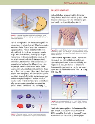 Electrocardiografía básica


                                                                    Las derivaciones

                                                                    La finalidad de una derivación electrocar­
                                                                    dio­gráfica es medir la corriente que va en la
                                                                    dirección marcada por una línea recta que
                                                                    une los electrodos utilizados. (fig. 6)




Figura 4. Electrodo explorador cerca del polo negativo. Note
que la aguja del galvanómetro se dirige hacia abajo (inscribe una
deflección negativa).


que el inscriptor de un electro­cardiógrafo se
mueve por el galvanómetro. El galvanómetro
es un medidor de corriente que pivota una
aguja adelante y atrás, dependiendo de la                           Figura 6. Derivación DII. Las flechas muestran la dirección de la
                                                                    corriente que evalúa esta derivación. El número mayor de flechas
dirección de la corriente que pasa a través                         representa las áreas de mayor influencia de la corriente eléctrica
suyo. Este movimiento de la aguja del gal­                          sobre la derivación.
va­nómetro es directamente responsable del                          Derivaciones bipolares: en una derivación
movimiento ascendente-descendente del                               bipolar de las extremidades se coloca un
inscriptor. El inscriptor está confeccionado                        electrodo positivo en una extremidad y uno
para pivotar hacia arriba si la corriente eléc­                     negativo en otra, midiendo la diferencia
tri­ca fluye en una dirección a través de la                        de potencial entre ambos. Las derivaciones
de­ri­va­ción, y hacia abajo si la corriente fluye                  bipolares de las extremidades son: DI, DII y
en la dirección opuesta (figs. 3 y 4). Los inge­                    DIII (fig. 7).
nie­ros han designado por convención como
positivo, a aquel electrodo que produ­ce una
deflección positiva (hacia arriba) en el ECG
cuando una corriente (vector) se acerca hacia
él y que produce una deflección negativa
(hacia abajo) cuando se aleja de él (fig. 5).




                                                                    Figura 7. Derivaciones bipolares DI, DII y DIII. Miden la diferen­
                                                                    cia de potenciales entre el electrodo positivo y negativo de cada
                                                                    derivación.


                                                                    Derivaciones unipolares de las extremi­da­
                                                                    des: fueron ideadas por Frank Wilson en
Figura 5. Electrodo positivo. Inscribe una deflección positiva
                                                                    1934 con el fin de medir la fuerza eléctrica
cuando el vector se dirige hacia él y negativa cuando se aleja.     absoluta de un electrodo positivo (+) en

                                                                                                                                    13
 
