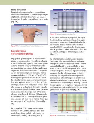 Electrocardiografía básica

Plano horizontal
Las derivaciones unipolares precordiales
miden la di­rec­ción de la corriente que va por
el plano horizontal (trans­ver­so), o sea, de
izquierda a derecha y de adelante hacia atrás
(fig. 18).




                                                             Figura 19. La cuadrícula electrocardiográfica.

                                                             Cada cinco cuadrículas pe­queñas, las rayas
                                                             horizon­tales y verticales del papel se repre­
                                                             sen­tan con una mayor inten­si­dad del color.
                                                             El objetivo de esto consiste en dividir el
Figura 18. Derivaciones del plano horizontal o transverso.
                                                             papel del ECG en cuadrículas de cinco por
                                                             cinco, quedando así cada cuadrado de 5 mm
La cuadrícula                                                de alto (0.5 mV) por 200 mseg de ancho
electrocardiográfica                                         (fig. 19).

El papel en que se registra el electrocardio­                La estandarización debe hacer­se durante
grama es termo­sensible (el estilo se calienta               200 mseg (cinco cua­drículas pequeñas) y
e inscribe el trazo) y por lo tanto no requiere              el re­gistro correcto debe mos­trar una forma
del uso de tinta. Este papel viene dividido                  cuadrada (fig. 20). La velocidad a la que
en cua­drículas. Los valores de las cuadrículas              corre el papel también se puede selec­cionar
dependen de la estan­da­riza­ción. La mayoría                desde una perilla diseña­da específicamente
de los electrocardió­gra­fos traen una perilla               para este fin. La velocidad usual es de 25
para estandarizar el ECG a 1 mV y 0.5 mV,                    mm/seg. En los pacientes con taquicardia
sólo algunos permiten estan­da­rizar a 2 mV.                 (incluyendo a los niños por su alta frecuen­
La estandarización que normal­mente se uti­                  cia cardíaca) algunas veces se pue­de registrar
liza para registrar un ECG es la de 1 mV. Sin                al doble de la veloci­dad (50 mm/seg.) con el
embargo, cuando los complejos son de muy                     fin de separar los complejos y poder determi­
alto voltaje se utiliza la de 0.5 mV y cuando                nar las caracte­rísticas del trazado electrocardio­­
son de muy bajo voltaje la de 2 mV. Cuando                   gráfico con mayor exactitud (fig. 20).
estan­darizamos el equipo en 1 mV el estilo
alcanza una altura de 10 mm. Si la estanda­
riza­ción se hace a 0.5 mV quiere decir que 1
mV equivale a 5 mm y si se hace a 2 mV, qui­
ere decir que 1 mV equivale a 20 mm (fig.
19).

En el papel de ECG con estan­darización
normal (1 mV), cada cuadrícula de 1 mm
equivale en altura (voltaje) a 0.1 mV y en
tiempo (a lo ancho) a 40 mseg (0.04”).                       Figura 20. Estandarización y velocidad del papel.

                                                                                                                 17
 
