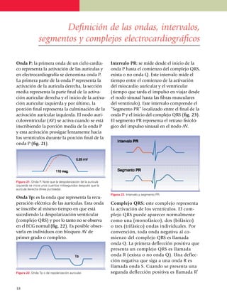 Definición de las ondas, intervalos,
                 segmentos y complejos electrocardiográficos

Onda P: la primera onda de un ciclo cardía­                       Intervalo PR: se mide desde el inicio de la
co representa la activación de las aurículas y                    onda P hasta el comienzo del complejo QRS,
en electrocardiografía se denomina onda P.                        exista o no onda Q. Este intervalo mide el
La primera parte de la onda P representa la                       tiempo entre el comienzo de la activación
activación de la aurícula derecha, la sección                     del miocardio auricular y el ventricular
media representa la parte final de la acti­va­                    (tiempo que tarda el impulso en viajar desde
ción auricular derecha y el inicio de la activa­                  el nodo sinusal hasta las fibras musculares
ción auricular izquierda y por último, la                         del ventrículo). Este intervalo comprende el
por­ción final representa la culmi­nación de la                   “Segmento PR” localizado entre el final de la
activación auricular izquierda. El nodo auri­                     onda P y el inicio del complejo QRS (fig. 23).
culoventricular (AV) se activa cuando se está                     El segmento PR represen­ta el retraso fisioló­
inscribiendo la porción media de la onda P                        gico del impulso sinusal en el nodo AV.
y esta activación prosigue lentamente hacia
los ventrículos durante la porción final de la
onda P (fig. 21).




Figura 21. Onda P. Note que la despo­lari­zación de la aurícula
izquierda se inicia unos cuantos milisegundos después que la
aurícula derecha (línea punteada).
                                                                  Figura 23. Intervalo y segmento PR.
Onda Tp: es la onda que representa la recu­
peración eléctrica de las aurículas. Esta onda                    Complejo QRS: este complejo representa
se inscribe al mismo tiempo en que está                           la activación de los ventrículos. El com­
sucediendo la despolarización ventricular                         plejo QRS puede aparecer normalmente
(complejo QRS) y por lo tanto no se observa                       como una (monofásico), dos (bifásico)
en el ECG normal (fig. 22). Es po­sible obser­                    o tres (trifá­si­co) ondas individuales. Por
varla en individuos con bloqueo AV de                             convención, toda onda negativa al co­
primer grado o completo.                                          mienzo del comple­jo QRS es llamada
                                                                  onda Q. La primera de­flec­ción positiva que
                                                                  presenta un complejo QRS es llamada
                                                                  onda R (exista o no onda Q). Una deflec­
                                                                  ción negativa que siga a una onda R es
                                                                  llamada onda S. Cuando se presenta una
Figura 22. Onda Tp o de repolarización auricular.                 segunda deflección positiva es llamada R’


18
 