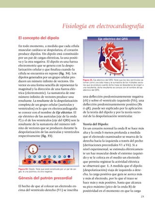 Fisiología en electrocardiografía
El concepto del dipolo

En todo momento, a medida que cada célula
muscular cardíaca se despolariza, el corazón
produce dipolos. Un dipolo está constituido
por un par de cargas eléctricas, la una posi­ti­
va y la otra negativa. El dipolo es una fuerza
electro­motriz que se genera con la despo­
la­rización celular y que finaliza cuando la
célula se encuentra en reposo (fig. 34). Los
dipolos generados por un grupo celular pro­
                                                                  Figura 35. Eje eléctrico del QRS. Note que los dos ventrículos se
du­cen un número infinito de vectores. Un                         toman como una sola masa y la sumatoria de los múltiples vecto­
vec­­tor es una forma sencilla de repre­sen­tar la                res que se produce cuando dicha masa se despolariza da origen a
                                                                  una resultante, dicha resultante se conoce con el nombre de eje
mag­nitud y la dirección de una fuerza eléc­                      eléctrico del QRS.
trica (electromotriz). La sumatoria de este
nú­me­ro infinito de vectores produce una                         una deflección predominantemente negativa
resul­tan­te. La resultante de la des­po­la­ri­zación             (rS) y sobre el ven­trículo izquierdo (V6), una
comple­­ta de un grupo celular (aurí­cu­las y                     deflección predominantemente positiva (Rs
ven­trícu­los) es lo que en electro­cardio­grafía                 ó qR), puede ser explicado por la aplicación
se cono­ce con el nombre de Eje eléc­tri­co. El                   de la teoría del dipolo y por la teoría vecto­
eje eléc­trico de las aurículas (eje de la onda                   rial de la despo­la­ri­zación ventricular.
P) y el de los ventrículos (eje del QRS) son la
resul­tante de la sumatoria del número infi­                      Teoría del Dipolo:
nito de vectores que se producen durante la                       En un corazón normal la onda R se hace más
despo­la­rización de las aurículas y ven­­trículos                alta y la onda S menos profunda a medida
res­pec­tivamente (fig. 35).                                      que el electrodo examinador se mueva de la
                                                                  derecha hacia la izquierda a través del pecho
                                                                  (derivaciones precordiales V1 a V6). Si a
                                                                  nivel experimental, se estimula eléctrica­men­
                                                                  te un haz muscular desde el extremo izquier­
                                                                  do y se le coloca en el medio un electrodo
                                                                  que permita registrar la actividad eléctrica
                                                                  se observará que: 1. A medida que el dipolo
Figura 34. Dipolo. Note que está constituido por un par de car­
gas, la una positiva y la otra negativa.
                                                                  (despolarización) viaja de izquierda a de­re­
                                                                  cha, la carga positiva que guía se acerca más
Génesis del patrón precordial                                     y más al electrodo, por lo que el trazo se
                                                                  hace más y más positivo, hasta que alcanza
El hecho de que al colocar un electrodo en­                       su pico máximo (pico de la onda R) de
cima del ventrículo derecho (V1) se inscriba                      po­­si­ti­vidad en el momen­to en que la carga
                                                                                                                                23
 