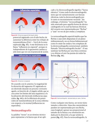 Fisiología en electrocardiografía

                                                    cado a la electrocar­diografía significa “fuerza
                                                    eléctrica”. Como toda la electrocardio­grafía
                                                    tiene que ver exclusi­va­mente con fuerzas
                                                    eléctricas, toda la electrocar­dio­grafía por
                                                    lo tanto es necesa­riamente vectorial. Sin
                                                    embar­go, el término “vectocar­dio­grafía” ha
                                                    sido reservado para aquella forma de electro­
                                                    cardiografía en la cual las fuerzas eléctricas
                                                    del corazón son representadas por “flechas”
                                                    y “asas” en vez de por ondas y complejos.
Figura 44. Influencia espacial del ángulo sólido.
                                                    La vectocardiografía espacial implica que las
   potencial registrado con el sólo hecho de
                                                    flechas o asas estén dispuestas en un plano
   aumentar la diferencia entre los voltajes de
                                                    tridimensional y no en forma bidi­mensional
   transmembrana (Vm1 – Vm2) de la zona
                                                    como lo están las ondas y los complejos de
   explo­rada (fig. 45). A este fenómeno se le
                                                    la electro­cardiografía conven­cional, también
   llama “influencia no espacial”, porque es
                                                    llamada “Elec­trocar­diografía Escalar”. El asa
   indepen­diente de la geometría cardíaca y
                                                    sustituye las flechas por una línea continua
   sólo tiene que ver con el potencial de acción.
                                                    y se obtiene al unir las puntas de todas las
                                                    flechas (fig. 46).




Figura 45. Influencia no espacial.

De acuerdo con lo anterior, la magnitud de
la elevación del segmento ST registrada en
un electrodo durante un proceso coronario
agudo, es función de: el ángulo sólido que se
crea entre los límites del área isquémica y la
localización del electrodo (influencias espa­
ciales, fig. 44) y de la diferencia de poten­       Figura 46. Vectocardiografía: representada por asas y flechas.

ciales de trans­membrana de la zona enferma
con respecto a la normal (influencias no            Como cualquier otra fuerza, un vector tiene
espaciales).                                        tamaño y di­rec­ción. Estas dos características
                                                    pueden ser representadas por una flecha,
Vectocardiografía                                   cuya longitud y grosor sea proporcional al
                                                    tamaño de la fuerza y su orientación sea
La palabra “vector” es un término técnico           dada por la dirección a la que señala la
para re­pre­sentar a la fuerza que al ser apli­     punta (fig. 47). Para la vectocardiografía, la
                                                                                                                     27
 