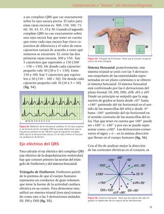 Interpretación o “lectura” del electrocardiograma

    a un complejo QRS que cae exactamente
    sobre la raya oscura previa. El valor para
    estas rayas oscuras es: 300, 150, 100, 75,
    60, 50, 43, 37, 33 y 30. Cuando el segundo
    complejo QRS no cae exactamente sobre
    una raya oscura hay que tener en cuenta
    que entre cada raya oscura hay cinco ca­
    joncitos de diferencia y el valor de estos
    cajoncitos variará de acuerdo a entre qué
    núme­ros se encuentre. Ej: entre las dos
    primeras rayas oscuras, 300 y 150, hay                             Figura 55. Triángulo de Einthoven. Note que el corazón ocupa el
                                                                       centro de este triángulo.
    5 cajoncitos que equivalen a 150 (300
    – 150 = 150). De donde cada cajoncito                              Sistema Hexoaxial: posteriormente, este
    pequeño vale 30 (30 x 5 = 150). Entre                              sistema triaxial se unió con las 3 deriva­cio­
    150 y 100, hay 5 cajoncitos que equiva­                            nes unipolares de las extremidades repre­
    len a 50 (150 – 100 = 50). De donde cada                           sentadas en un plano cartesiano y se obtuvo
    cajon­ci­to pequeño vale 10 (10 x 5 = 50)                          el sistema hexoaxial. El sistema hexoaxial
    (fig. 54).                                                         está confor­mado por las 6 derivaciones del
                                                                       plano frontal, DI, DII, DIII, aVR, aVL y aVF.
                                                                       Desde un principio se estipuló que la asig­
                                                                       nación de grados se haría desde +O° hasta
                                                                       +180° par­tiendo del eje horizontal en el sen­
                                                                       tido de las manecillas del reloj y desde -0°
                                                                       hasta -180° partiendo del eje horizontal en
                                                                       el sentido contrario de las manecillas del re­
                                                                       loj. Hay que tener en cuenta que 180° puede
Figura 54. Medición de la frecuencia cardíaca. En el trazo superior    ser +180° ó -180° y por eso se puede repre­
si se toma el primer complejo QRS se puede determinar que la           sentar como ±180°. Las derivaciones conser­
frecuen­cia cardíaca es de 100 lpm pues el siguiente complejo
QRS cae en la tercera línea oscura. En el trazo inferior la frecuen­   varon el signo + ó – en la misma dirección
cia cardíaca es de 54 lpm.                                             que llevan en el cuerpo humano (fig. 56).

Eje eléctrico del QRS                                                  Con el fin de analizar mejor la dirección
Para calcular el eje eléctrico del complejo QRS                        de las corrientes eléctricas en el corazón, es
(eje eléctrico de la despolarización ventricular)
hay que conocer primero las teorías del trián­
gulo de Einthoven y del sistema hexoaxial.

Triángulo de Einthoven: Einthoven partió
de la premisa de que el cuerpo humano
representa un conductor de gran volumen
que tiene la fuente de la actividad cardíaca
eléctrica en su centro. Para demostrar esto,
utilizó un sistema triaxial (tres ejes) toman­
do como ejes a las 3 derivaciones estándar,                            Figura 56. Sistema hexoaxial. Note que los signos del valor en
DI, DII y DIII (fig. 55).                                              grados no depen-­den de los signos de las derivaciones.


                                                                                                                                    31
 