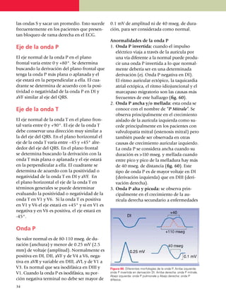 las ondas S y sacar un pro­me­dio. Esto sucede   0.1 mV de amplitud ni de 40 mseg. de dura­
fre­cuen­temente en los pacientes que pre­sen­   ción, para ser consi­de­rada como normal.
tan bloqueo de rama derecha en el ECG.
                                                 Anormalidades de la onda P
Eje de la onda P                                 1.	 Onda P invertida: cuando el impulso
                                                     eléctrico viaja a través de la aurícula por
El eje normal de la onda P en el plano               una vía diferente a la normal puede pro­du­
frontal varía entre 0 y +80°. Se determina           cir una onda P invertida a lo que normal­
buscando la derivación del plano frontal que         mente debería ser en una deter­mi­nada
tenga la onda P más plana o aplanada y el            derivación (ej. Onda P negativa en DI).
eje estará en la perpendicular a ella. El cua­       El ritmo auricular ectópico, la taquicardia
drante se determina de acuerdo con la posi­          atrial ectópica, el ritmo idiojuncional y el
tividad o nega­ti­vi­dad de la onda P en DI y        marcapaso migratorio son las causas más
aVF similar al eje del QRS.                          frecuentes de este hallazgo (fig. 60).
                                                 2.	 Onda P ancha y/o mellada: esta onda se
Eje de la onda T                                     conoce con el nombre de “P Mitrale”. Se
                                                     observa principalmente en el creci­miento
El eje normal de la onda T en el plano fron­         aislado de la aurícula izquierda como su­
tal varía entre 0 y +90°. El eje de la onda T        cede princi­palmente en los pacientes con
debe conservar una dirección muy similar a           valvulo­patía mitral (estenosis mitral) pero
la del eje del QRS. En el plano horizontal el        también puede ser observada en otras
eje de la onda T varía entre –45 y +45° al­re­       causas de creci­miento auri­cular izquierdo.
dedor del eje del QRS. En el plano frontal           La onda P se considera ancha cuando su
se determina buscando la derivación con la           duración es >110 mseg. y mellada cuando
onda T más plana o aplanada y el eje estará          entre pico y pico de la melladura hay más
en la perpendicular a ella. El cuadran­te se         de 40 mseg. de distan­cia (fig. 60). Este
deter­mi­na de acuerdo con la positi­vi­dad o        tipo de onda P es de mayor voltaje en DI
negatividad de la onda T en DI y aVF. En             (deri­vación izquierda) que en DIII (deri­
el plano horizontal el eje de la onda T en           vación derecha).
tér­mi­nos generales se puede determinar         3.	 Onda P alta y picuda: se observa prin­
eva­luando la positividad o negatividad de la        cipalmente en el creci­miento de la au­
onda T en V1 y V6. Si la onda T es positiva          rícula derecha secundario a enfer­medades
en V1 y V6 el eje estará en +45° y si en V1 es
negativa y en V6 es positiva, el eje estará en
-45°.

Onda P
Su valor normal es de 80-110 mseg. de du­
ra­ción (anchura) y menor de 0.25 mV (2.5
mm) de voltaje (amplitud). Normal­mente es
positiva en DI, DII, aVF y de V4 a V6, nega­
ti­va en aVR y variable en DIII, aVL y de V1 a
V3. Es normal que sea isodifásica en DIII y      Figura 60. Diferentes morfologías de la onda P. Arriba izquierda:
V1. Cuando la onda P es isodifá­si­ca, su por­   onda P invertida en derivación DI. Arriba derecha: onda P mitrale.
                                                 Abajo izquierda: onda P pulmonale y Abajo derecha: onda P
ción negativa terminal no debe ser mayor de      difásica.

34
 