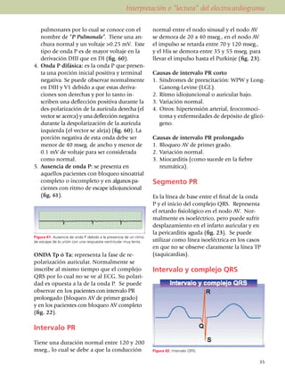 Interpretación o “lectura” del electrocardiograma

    pulmonares por lo cual se conoce con el                       normal entre el nodo sinusal y el nodo AV
    nombre de “P Pulmo­­nale”. Tiene una an­                      se demora de 20 a 40 mseg., en el nodo AV
    chura normal y un voltaje >0.25 mV. Este                      el impulso se retarda entre 70 y 120 mseg.,
    tipo de onda P es de mayor voltaje en la                      y el His se demora entre 35 y 55 mseg. para
    derivación DIII que en DI (fig. 60).                          llevar el impulso hasta el Purkinje (fig. 23).
4.	 Onda P difásica: es la onda P que presen­
    ta una porción inicial positiva y terminal                    Causas de intervalo PR corto
    negativa. Se puede observar normalmente                       1.	 Síndromes de preexcitación: WPW y Long-
    en DIII y V1 debido a que estas deri­va­                          Ganong-Levine (LGL).
    ciones son derechas y por lo tanto in­                        2.	 Ritmo idiojuncional o auricular bajo.
    scriben una deflec­ción positiva durante la                   3.	 Variación normal.
    des­-­­polarización de la aurí­cula derecha (el               4.	 Otros: hipertensión arterial, feocromoci­
    vector se acerca) y una de­flección negativa                      toma y enferme­dades de depósito de glicó­
    durante la despo­la­rización de la aurícula                       geno.
    izquierda (el vector se aleja) (fig. 60). La
    porción negativa de esta onda debe ser                        Causas de intervalo PR prolongado
    menor de 40 mseg. de ancho y menor de                         1.	 Bloqueo AV de primer grado.
    0.1 mV de voltaje para ser considerada                        2.	 Variación normal.
    como normal.                                                  3.	 Miocarditis (como sucede en la fiebre
5.	 Ausencia de onda P: se presenta en                                reumática).
    aquellos pa­cien­tes con bloqueo sinoatrial
    completo o incompleto y en algunos pa­                        Segmento PR
    cientes con ritmo de escape idiojuncional
    (fig. 61).                                                    Es la línea de base entre el final de la onda
                                                                  P y el inicio del complejo QRS. Representa
                                                                  el retardo fisiológico en el nodo AV. Nor­
                                                                  malmente es isoeléc­tri­co, pero puede sufrir
                                                                  despla­zamiento en el infarto auricular y en
                                                                  la pericarditis aguda (fig. 23). Se puede
Figura 61. Ausencia de onda P debido a la presencia de un ritmo
de escape de la unión con una respuesta ventricular muy lenta.    utilizar como línea isoeléctrica en los casos
                                                                  en que no se observe clara­men­te la línea TP
ONDA Tp ó Ta: representa la fase de re­                           (taquicardias).
polarización auricular. Normalmente se
inscribe al mismo tiempo que el complejo                          Intervalo y complejo QRS
QRS por lo cual no se ve al ECG. Su polari­
dad es opuesta a la de la onda P. Se puede
observar en los pacientes con intervalo PR
pro­lon­gado (bloqueo AV de primer grado)
y en los pacientes con bloqueo AV completo
(fig. 22).

Intervalo PR
Tiene una duración normal entre 120 y 200
mseg., lo cual se debe a que la conducción                        Figura 62. Intervalo QRS.

                                                                                                               35
 