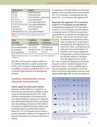 Enfermedad coronaria al electrocardiograma

 Derivaciones	         Región                          Los pacientes con IAM inferior en evolución
 DI-aVL	               Cara lateral alta               pueden cursar con derivaciones precordiales
 V5-V6	                Cara lateral baja               (V1 a V3) normales, con depresión del seg­
 V1-V2	                Cara posterior o septal pura    mento ST o con elevación del segmento ST.
 V1-V2-V3	             Cara anteroseptal
 V1-V2-V3-V4	          Cara anteroseptoapical                Depresión del segmento ST en las de­ri­va­
 V1-V2-V3-V4-V5-V6	    Cara anteroseptolateral               ciones V1 a V3 durante un IAM inferior:
 V3R-V4R	              Ventrículo derecho                    la depresión del segmento ST en las deri­va­
 DII-DIII-aVF	         Cara inferior                         ciones V1, V2 y V3 durante un IAM inferior
 DII-DIII-aVF-V1-V2	   Cara posteroinferior                  se presenta en un 50-70% de los pacientes
Tabla 3. Localización electrocardiográfica del evento        y generalmente se resuelve en las siguientes
coronario.                                                   48-72 horas. Sólo en un 16% de los casos
 Área	                     Cambios	             Cambios                 se presenta una depresión persis­
 afectada	                 indicativos	         recíprocos              ten­te. En general, se acepta que si
 Cara inferior	            DII-DIII-aVF	 DI-aVL (V1,V2,V3) esta depresión del segmento ST es
 Cara anteroseptal	 V1-V2-V3	                   DII-DIII-aVF            menor de 3 mm, se presenta en las
 Cara lateral	             DI-aVL-V5-V6	 V1-V3R-V4R                     primeras 6 horas del infarto y se
 Cara posterior	           V7-V8-V9	            V1-V2                   resuelve en las 6 horas si­guientes
                                                                        corresponde a cambios recipro­can­
Tabla 4. Áreas afectadas con sus respectivos cambios indicativos y
recíprocos.
                                                                        tes del IAM inferior. Si la depre­
                                                                        sión del segmento ST es mayor
DII, DIII y aVF la arteria compro­metida es                  de 3 mm, se presenta después de 6 horas de
la coronaria derecha; cuando se presentan                    iniciado el dolor o persiste después de las
en DI y aVL, la arteria compro­me­ti­da es la                primeras 6 horas, es muy pro­bable que se
circunfleja y cuando se presentan de V1 a V6, trate de isque­mia concomitante en el te­rri­
la arteria comprometida es la descen­dente                   torio de la arteria descen­dente anterior (cara
anterior.                                                    anterosep­tal) (fig. 96). En estos pacientes es

Cambios reciprocantes versus
isquemia concomitante

Infarto agudo del miocardio inferior:
duran­te un IAM inferior en evolución, es
fre­cuen­te que se presenten cambios reci­pro­
can­tes en las deri­va­cio­nes DI y aVL. Estos
cambios corres­ponden al fenómeno de la
cara diame­tral­mente opuesta y no repre­sen­
tan enfermedad isqué­mica de la cara lateral
alta. Sin embargo, durante un IAM inferior
en evolución también hay que evaluar muy
cuida­do­sa­mente las derivaciones pre­cor­
dia­les (V1, V2 y V3) puesto que en ellas se
pue­­den presentar cambios en el segmento ST
durante las primeras 24 horas de iniciado el           Figura 96. IAM inferior con depresión del ST de V1 a V3. La
                                                       depresión del ST en las derivaciones DI y aVL en estos casos
infarto.                                               siempre será por imagen recíproca.


                                                                                                                      55
 
