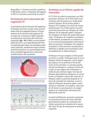 Enfermedad coronaria al electrocardiograma

desarrollen: 1. Arritmia auricular, usual­men­                     Arritmias en el infarto agudo de
te fibrilación atrial, 2. Depresión del seg­men­­                  miocardio
to PR ó 3. Contorno anormal de la onda P.
                                                                   El 75-95% de todos los pa­cien­tes con IAM
Persistencia de la ele­va­ción del                                 presentan arri­t­mias. En el IAM inferior las
                                                                   arritmias más frecuentes son: bradicardia
segmento ST
                                                                   sinusal, bloqueo AV de primer grado y
                                                                   bloqueo AV completo con ritmo de escape
La persistencia de la elevación del segmento
                                                                   idiojuncional. En el IAM an­terior las arrit­
ST durante un IAM se acepta como normal
                                                                   mias más frecuentes son: bloqueo de rama,
hasta el fin de la segunda semana. Si la per­
                                                                   bloqueo AV de segundo grado y bloqueo
sistencia de la elevación del segmento ST
                                                                   AV completo con ritmo de escape idioven­tri­
es mayor de 2 semanas se debe sospechar
                                                                   cu­lar. El bloqueo AV completo secundario
la presencia de aneurisma del ventrículo
                                                                   a IAM inferior, usualmente es tran­si­torio y
iz­quierdo (figs. 103 y 104) con una sensi­bi­
                                                                   en los casos más pro­longados tarda hasta 8
li­dad del 65% y una especi­ficidad del 95%.
                                                                   días en resolverse. El bloqueo AV completo
Los pacientes que cursan con aneurisma ven­tri­
                                                                   se­­cun­dario a IAM anteriores usualmente es
cular izquier­do, usualmente tienen infartos
                                                                   de­fi­ni­tivo y significa peor pro­nóstico (alta
anteriores extensos con anor­malidad severa
                                                                   mor­ta­li­dad por el infarto mismo).
de la motilidad segmentaria y pre­sen­tan
trombos dentro del aneurisma.
                                                                   El bloqueo AV que complica al IAM puede
                                                                   ser precoz o tardío. El bloqueo precoz es un
                                                                   blo­­queo súbito de segundo o tercer grado
                                                                   que aparece en las pri­meras 6 horas del
                                                                   inicio de los síntomas. La atropina puede
                                                                   revertir este bloqueo o acelerar el ritmo de
                                                                   escape, lo que su­giere que el bloqueo es
                                                                   inducido por estí­mulo vagal. Este tipo de
                                                                   bloqueo general­men­te desaparece en 24-48
                                                                   horas y es debido a edema del nodo AV. El
                                                                   bloqueo tardío se presenta después de 24
Figura 103. Aneurisma de la pared anterior del ventrículo izqui­
erdo. Note que el músculo normal está reemplazado por tejido       horas de iniciados los síntomas, es prece­
colágeno cicatricial.                                              dido por bloqueo de pri­mer grado, usual­
                                                                   mente no responde a la atropina, dura más
                                                                   de 36 horas o es perma­nente y su origen
                                                                   implica un compromiso estructural por
                                                                   fibrosis del nodo AV.

                                                                   Cuando la fibrilación auricular se presenta
                                                                   en las primeras horas del inicio del IAM,
                                                                   ge­­ne­ral­mente implica la coexis­ten­cia de
                                                                   infarto auricular por oclusión de la arteria
Figura 104. Persistencia de la elevación del segmento ST de V1     del nodo AV que da ramas para la aurícula
a V5 en un paciente con un infarto anteroseptal de 3 meses de
evolución.
                                                                   izquierda.


                                                                                                                59
 