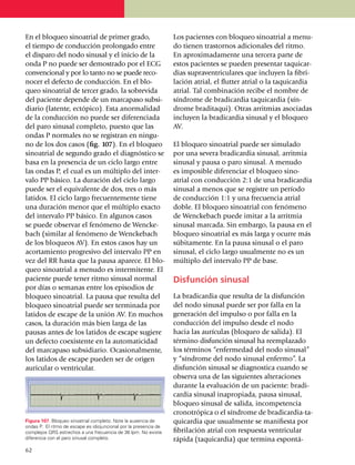 En el bloqueo sinoatrial de primer grado,                          Los pacientes con bloqueo sinoatrial a me­nu­
el tiempo de conducción prolongado entre                           do tienen tras­tornos adicionales del ritmo.
el disparo del nodo sinusal y el inicio de la                      En aproximadamente una tercera parte de
onda P no puede ser demostrado por el ECG                          estos pacientes se pueden presentar taqui­car­
convencional y por lo tanto no se puede re­co­                     dias supraventriculares que incluyen la fibri­
nocer el defecto de conducción. En el blo­                         lación atrial, el flutter atrial o la taqui­­cardia
queo sinoatrial de tercer grado, la sobre­vida                     atrial. Tal combi­nación recibe el nombre de
del paciente depende de un marcapaso subsi­                        síndrome de bradicardia taqui­car­dia (sín­
dia­rio (latente, ectópico). Esta anor­ma­lidad                    drome braditaqui). Otras arrit­mias asocia­das
de la conducción no puede ser dife­ren­ciada                       incluyen la bradi­cardia sinusal y el bloqueo
del paro sinusal completo, puesto que las                          AV.
ondas P normales no se registran en ningu­
no de los dos casos (fig. 107). En el bloqueo                      El bloqueo sinoatrial puede ser simulado
sinoatrial de segundo grado el diagnóstico se                      por una severa bra­di­cardia sinusal, arritmia
basa en la pre­sencia de un ciclo largo entre                      sinusal y pausa o paro sinusal. A menudo
las ondas P, el cual es un múltiplo del inter­                     es imposible dife­renciar el blo­queo sino­
valo PP básico. La dura­ción del ciclo largo                       atrial con con­ducción 2:1 de una bradicar­dia
puede ser el equi­valente de dos, tres o más                       sinu­­sal a menos que se registre un período
latidos. El ciclo lar­go fre­cuentemente tiene                     de con­ducción 1:1 y una frecuen­cia atrial
una duración me­nor que el múltiplo exacto                         doble. El bloqueo sinoa­trial con fenó­meno
del intervalo PP básico. En algunos casos                          de Wenckebach puede imitar a la arritmia
se puede obser­var el fenómeno de Wencke­                          sinusal marcada. Sin embargo, la pausa en el
bach (similar al fenó­me­no de Wenckebach                          blo­queo sinoatrial es más larga y ocurre más
de los bloqueos AV). En estos casos hay un                         súbitamente. En la pausa sinusal o el paro
acortamiento progre­sivo del intervalo PP en                       sinusal, el ciclo largo usual­mente no es un
vez del RR hasta que la pausa aparece. El blo­                     múltiplo del intervalo PP de base.
queo sino­atrial a menudo es inter­mitente. El
paciente puede tener ritmo sinusal normal                          Disfunción sinusal
por días o sema­nas entre los episodios de
bloqueo sinoatrial. La pausa que resulta del                       La bradicardia que resulta de la disfunción
bloqueo sinoatrial puede ser terminada por                         del nodo sinusal puede ser por falla en la
latidos de escape de la unión AV. En muchos                        gene­ración del impulso o por falla en la
casos, la duración más bien larga de las                           conducción del impulso desde el nodo
pausas antes de los latidos de escape sugiere                      hacia las aurículas (bloqueo de salida). El
un defecto coexis­ten­te en la automaticidad                       término disfunción sinusal ha reempla­zado
del marca­pa­so sub­si­diario. Ocasionalmente,                     los tér­mi­nos “enfermedad del nodo sinusal”
los latidos de escape pueden ser de origen                         y “sín­drome del nodo sinusal enfermo”. La
auricular o ventricular.                                           dis­función sinusal se diagnostica cuando se
                                                                   observa una de las siguientes alteraciones
                                                                   durante la evalua­ción de un paciente: bradi­
                                                                   car­dia sinusal inapropiada, pausa sinusal,
                                                                   bloqueo sinusal de salida, in­competencia
                                                                   crono­trópica o el síndrome de bradicardia-ta­
Figura 107. Bloqueo sinoatrial completo. Note la ausencia de       qui­cardia que usualmente se manifiesta por
ondas P. El ritmo de escape es idiojuncional por la presencia de
complejos QRS estrechos a una fre­cuen­cia de 36 lpm. No existe    fibrilación atrial con respuesta ventricular
diferencia con el paro sinusal completo.                           rápida (taquicardia) que termina espon­tá­
62
 