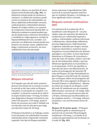 Trastornos de la conducción cardíaca

neamente y alterna con períodos de ritmo                                mente re­presenta el agran­da­miento (dila­
idiojuncional (bradicardia) (fig. 108). La                              ta­ción) de la aurícula izquierda más bien
dis­función sinusal puede ser intrínseca o                              que un verdadero bloqueo, y su hallazgo no
extrínseca. La disfunción intrínseca puede                              tiene signi­ficado clínico conocido.
ocurrir en presencia de enfermedades car­
día­cas adquiridas (enfer­me­dad coronaria,                             Bloqueos aurículo ventriculares
car­dio­miopatías y enfer­medad valvular),                              (AV)
des­pués de cirugía cardíaca o en ausencia
de compro­miso estructural identificable. La                            Los trastornos de la conducción AV se
disfunción extrínseca se puede producir por                             mani­fiestan como bloqueos AV. Las prin­
uso de me­di­ca­cio­nes, trastornos electro­líticos                     cipales causas de trastornos del sistema de
y meta­bó­licos e hipervagotonía, incluida la                           con­ducción son: enferme­dad isquémica
hipersen­sibilidad del seno carotídeo. Los                              car­día­ca, enfer­me­dades cardíacas infecciosas
pacien­tes con disfunción sinusal pueden pre­                           e inflamatorias, enferme­dades infil­trativas,
sentarse con sínco­pe, mareo, palpitaciones,                            procesos dege­ne­rativos, malformaciones
fatiga o intolerancia al ejercicio, sin anor­                           con­génitas, inducidos por drogas y toxinas,
malidad del ritmo docu­mentada.                                         trastornos electro­lí­ti­cos, trastornos neuro­
                                                                        mio­pá­ticos y los procedimientos de ablación
                                                                        quirúrgica o con catéter. Es muy importante
                                                                        determinar si el bloqueo AV es proximal a
                                                                        nivel del nodo AV (nodal) o distal a nivel del
                                                                        haz de His (infranodal), debido a que hay
                                                                        diferencias signifi­ca­tivas en el pronóstico y
                                                                        en el tratamiento. El ECG de superficie es
                                                                        muy útil para hacer esta diferenciación: un
Figura 108. Síndrome de taqui-bradi. Inicia con fibrilación atrial de   patrón de prolongación del intervalo PR
respuesta ventricular rápida (taqui), sigue una pausa y el ritmo de     antes del bloqueo AV (tipo Wenckebach) su­
escape es de tipo idiojuncional (bradi).
                                                                        giere bloqueo a nivel del nodo AV, mien­tras
Bloqueo intraatrial                                                     que un bloqueo súbito sin prolongación del
                                                                        intervalo PR es muy sugestivo de blo­queo in­
Si el impulso que sale del nodo sinusal se                              franodal (Hisiano o infra­Hisiano). Ade­más,
demora más tiempo de lo normal en activar                               los ritmos de escape de un bloqueo a nivel
la aurícula se dice que existe un bloqueo                               del nodo AV usualmente son de complejos
intraatrial, el cual puede ser completo o in­                           QRS estrechos, menores de 120 msegs. (idio­
completo. La duración normal de la onda P                               jun­cionales), y con una fre­cuen­cia entre 40
se acepta máxima hasta 110 mseg. El criterio                            y 60 lpm, mientras que los in­fra­nodales son
para diagnosticar bloqueo intraatrial es una                            de complejos anchos, > 120 msegs. (idioven­
onda P de duración >120 mseg y ayuda el                                 triculares), y con una fre­cuencia menor de
hecho de encontrar una onda P mellada con                               40 lpm.
un intervalo entre los dos picos que tenga
una duración mayor de 40 mseg.                                          Bloqueo AV de primer grado. El bloqueo
                                                                        AV de primer grado se caracteriza por la
El bloqueo intraatrial es un hallazgo común                             presencia de un intervalo PR prolongado,
en los pa­cien­tes con enfermedad coronaria,                            usualmente >210 mseg., y el retardo de la
enfermedad mitral o hiper­tro­fia ventricular                           conducción generalmente está localizado en
izquierda. Este tipo de bloqueo proba­ble­                              el nodo AV (fig. 109).
                                                                                                                     63
 