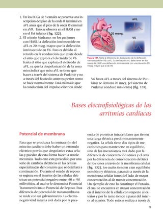 1.	 En los ECGs de 3 canales se presenta una in­
    scripción del pico de la onda R terminal en
    aVL antes que el pico de la onda R ter­minal
    en aVR. Esto se observa en el HASI y no
    en el IM inferior (fig. 122).
2.	 El criterio Medrano: en los pacientes
    con HASI, la deflección intrinsecoide en
    aVL es 20 mseg. mayor que la deflección
    in­trinsecoide en V6. Esto es debido al
    retardo en la con­ducción que existe desde
    el sitio que explora el electrodo de V6        Figura 131. Note la diferencia en la duración de la deflección
                                                   intrinsecoide en V6 y aVL. La derivación aVL debe tener en los
    hasta el sitio que explora el electrodo de     casos de HASI una deflección intrinsecoide con una duración 20
    aVL, ya que la despo­la­riza­ción de la zona   mseg. mayor que la de V6.

    miocárdica que mira aVL se tiene que
    hacer a través del sistema de Purkinje y no
    a través del fascículo anterosu­perior como       V6 hasta aVL a través del sistema de Pur­
    se hace normal­mente. Está estimado que           kinje se demora 20 mseg. (el sistema de
    la con­ducción del impulso eléc­trico desde       Purkinje con­duce más lento) (fig. 131).




                                       Bases electrofisiológicas de las
                                                  arritmias cardíacas

Potencial de membrana                              encia de proteínas intracelulares que tienen
                                                   una carga eléctrica predomi­nan­temente
Para que se produzca la contracción del            negativa. La célula tiene dos tipos de me­
miocito cardíaco debe haber un estímulo            canismos para mantenerse en equi­librio,
eléctrico previo que despolarice estas cé­lu­      uno de los mecanismos está dado por la
las y puedan de esta forma hacer la sístole        diferencia de concentración iónica y el otro
mecánica. Todo esto está precedido por una         por la diferencia de concen­tración eléctrica
serie de cambios eléctricos en las cé­lulas        de los iones a través de la membrana celular
especializadas del corazón que se detallará a      (fig. 132), los cuales tienden a un equilibrio
con­ti­nuación. Durante el estado de re­po­so      osmótico y eléctrico, pa­san­do a través de la
se registra en el interior de las células eléc­    membrana celular iones del lado de mayor
tricas un potencial ne­ga­ti­vo entre -60 a -90    concentración al de me­nor concentración.
mili­voltios, al cual se le denomina Po­ten­cial   Un ejemplo de esto lo constituye el Potasio,
Transmembrana o Po­ten­cial de Reposo. Esta        el cual se encuentra en mayor concentración
diferencia de potencial de trans­membrana          en el interior de la célula con res­pecto al ex­
se mide con un galvanó­me­tro. La electro­         terior y por lo tanto tiende a pasar del interi­
negatividad interna está dada por la pres­         or al exterior. Todo esto se realiza a través de

                                                                                                                71
 