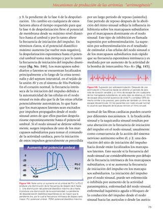 Mecanismos de producción de las arritmias “arritmogénesis”

y 3. la pendiente de la fase 4 de la despola­ri­                      por un largo período de reposo (asistolia).
zación. Un cambio en cualquiera de estos                              Este período de reposo des­pués de la abo­li­
factores altera el tiempo requerido para que                          ción del ritmo sinusal refleja la influencia in­
la fase 4 de despolarización lleve el potencial                       hibitoria sobre los marcapasos subsi­dia­rios
de membra­na desde su máximo nivel diastó­                            por el marcapasos domi­nante en el no­do
lico hasta el umbral y por lo tanto altere                            sinusal. Este tipo de inhibición es llamada
la frecuencia de iniciación del impulso. En                           supresión por sobre­es­ti­mulación. La supre­
términos claros, si el potencial diastólico                           sión por sobreesti­mula­ción es el resul­tado
máximo aumenta (se vuelve más negativo),                              de estimular a las células del nodo sinusal o
la despo­la­rización espontánea hasta el po­ten­                      de los mar­capasos subsi­diarios más rápido
cial umbral toma más tiempo y por lo tanto                            que su frecuencia espon­tánea intrín­seca y es
la fre­cuen­cia de iniciación del impulso dis­mi­                     mediada por un aumen­to de la actividad de
nuye (fig. No. 144). Los marcapasos subsi­                            la bomba de inter­cambio Na+-K+ (fig. 145).
diarios o latentes se encuentran loca­li­za­dos
principalmente a lo largo de la crista termi­                         Las arritmias causadas por la automaticidad
nalis y del septum interatrial, en el tejido de
la unión AV y en el sistema de His-Purkinje.
En el corazón normal, la frecuencia intrín­                           Figura 145. Supresión por sobreestimulación. Después de una
                                                                      estimu­la­ción a frecuencia rápida se obtiene un período de asis­
se­ca de la iniciación del impulso de­­bida a                         tolia de duración variable y un ritmo de escape de uno cualquiera
la automaticidad de las células en el nodo                            de los marcapasos subsidiarios, en este caso se observa un ritmo
                                                                      de escape idiojuncional (ausencia de onda P y complejo QRS es­
sinusal es más alta que la de las otras células                       trecho similar a los previos), pero podría ser también un ritmo de
potencialmente automáticas, lo que hace                               escape idioventri­cu­lar. En los pacientes con nodo sinusal normal
                                                                      lo usual es que después de la pausa reinicie un ritmo sinusal.
que los marcapasos latentes sean excitados
por impulsos propagados desde el nodo                                 normal de las fibras cardíacas pueden ocurrir
sinusal antes de que ellos puedan despola­                            por diferentes mecanismos: 1. la bradicardia
ri­zarse espontá­neamente hasta el potencial                          sinusal y la taquicardia sinusal resultan por
umbral. Si el nodo sinusal se de­tie­ne súbita­                       una alteración en la frecuencia de iniciación
mente, surgen impulsos de uno de los mar­                             del impulso en el nodo sinusal, usualmente
ca­pasos subsi­diarios para tomar el comando                          como consecuencia de la acción del sistema
de la actividad cardíaca, pe­ro la iniciación
                                                                      nervioso autónomo sobre él, y 2. una des­
de estos impulsos general­mente es precedida
                                                                      via­ción del sitio de iniciación del impulso
                                                                      hacia donde están localizados los marca­pa­
                                                                      sos la­tentes. Esto sucede si la frecuencia del
                                                                      nodo sinusal cae considerablemente por de­ba­jo
                                                                      de la frecuencia intrínseca de los marcapasos
                                                                      subsidiarios, o si se aumenta la frecuencia
                                                                      de iniciación del impulso en los marcapa­
                                                                      sos subsidiarios. La ini­ciación del impulso
                                                                      por el nodo sinusal, puede ser enlen­tecida
Figura 144. Note como un aumento en el umbral de PU-1 a PU-2          o inhi­bi­da por aumento de la actividad
produce una disminución de la frecuencia de disparo de b hasta        parasimpá­ti­ca, enfermedad del nodo sinusal,
c. Una disminución del potencial diastólico máximo de a hasta
d produce una disminución de la automaticidad. La pendiente           enferme­dad isquémica aguda o bloqueo de
de despolarización diastólica espontánea a-c es mayor que la
pendiente d-e, por lo cual la frecuencia intrínseca de disparo será   la con­ducción del impulso desde el nodo
mayor. PU: potencial umbral. PDM: potencial diastólico máximo.        sinusal hacia las aurículas o desde las aurícu­

                                                                                                                                     79
 