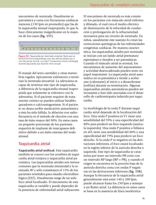 Taquicardias de complejos estrechos

mecanismo de reentrada. Usualmente es                           El meca­nis­mo de reentrada es más común
paroxística y cursa con fre­cuen­cias cardíacas                 en los pacientes con músculo atrial enfermo
menores (130 lpm en pro­me­dio) que las de                      y dilatado, el cual crea el medio eléctrico
la taquicardia sinusal inapro­pia­da, lo que la                 de disminución de la velocidad de conduc­
hace clínicamente insignifi­cante en la mayo­                   ción y prolongación de la refracta­rie­dad,
ría de los casos (fig. 157).                                    necesarios para un circuito de reen­tra­da. En
                                                                niños, usual­mente este sustrato lo crean las
                                                                correccio­nes quirúrgicas de las enfer­me­dades
                                                                congénitas cardíacas. De manera caracter­
                                                                ística, las taqui­cardias atria­les por reen­trada
Figura 157. Taquicardia por reentrada sinoatrial. Note que se   se inician con un latido atrial prematuro
termina en forma espontánea y los dos últimos latidos son a
una frecuencia normal. La onda P conserva la misma morfología
                                                                espontáneo y tienden a ser paroxísticas.
durante taquicardia que durante ritmo sinusal.                  Cuando el músculo atrial es normal, los
                                                                meca­nismos de aumento del auto­matismo
                                                                y actividad desencadenada pue­den tener un
El masaje del seno carotídeo y otras manio­                     papel impor­tante. La ta­qui­cardia atrial auto­
bras vagales, típi­ca­mente enlentecen o ter­mi­                mática no es paro­xís­tica y tiende a aceler­
nan la reentrada sinoa­trial. La ade­no­sina es                 arse (ca­len­tarse) al inicio y a desacelerarse
capaz de terminar este tipo de taqui­cardia,                    (enfriar) durante su termi­na­ción. Algunas
a dife­rencia de la taqui­cardia sinusal inapro­                taqui­cardias atriales auto­má­ti­cas pue­den ser
piada que solamente se enlentece con la                         incesantes y han sido aso­cia­das con el desar­
adenosina. Si el paciente requiere de trata­                    rollo de cardio­mio­patía inducida por taqui­
miento crónico se pueden utilizar betablo­                      cardia.
quea­dores o calcioan­ta­gonistas. Si el pa­cien­
te no desea recibir medicación antiarrítmica                    La morfología de la onda P durante taqui­
o ésta ha sido fallida, la ablación con radio­                  car­dia atrial depende de la localización del
fre­cuencia es el método de elección con una                    foco. Una onda P positiva en V1 tiene una
tasa de éxito mayor del 90%. En estos casos                     sensibilidad del 93% y una especificidad del
un pequeño porcentaje de los pacientes                          88% para predecir un foco izquierdo (aurí­cu­
requerirá de implante de marcapasos de­fi­                      la izquierda). Una onda P positiva o bifásica
ni­tivo debido a un daño extenso del nodo                       en aVL tiene una sensibilidad del 88% y una
sinusal.                                                        especi­ficidad del 79% para predecir un foco
                                                                derecho. Si la onda P es negativa en las deri­
Taquicardia atrial                                              vaciones inferiores, el foco estará loca­li­zado
                                                                en la región inferior de la aurícula derecha o
Taquicardia atrial unifocal. Esta taquicardia                   izquierda. Este tipo de taquicardia se carac­
también se conoce con los nombres de taqui­                     te­riza por tener un in­ter­va­lo PR corto con
cardia atrial ectópica y ta­quicardia atrial pa­                un intervalo RP largo (RP > PR), y cuando el
ro­xística. Las taquicardias atriales son menos                 origen se encuentra en la porción baja de la
comunes que la reen­trada intranodal y la re­                   aurícula derecha cursa con ondas P negati­
entrada AV y sólo constituyen el 15% de los                     vas en las derivaciones inferiores (fig. 158).
pacientes remi­ti­dos para estudio elec­tro­fisio­              Aunque la frecuencia de la taquicardia atrial
ló­gico (EEF). Usualmente surge de un solo                      generalmente está entre 140 y 200 lpm,
foco atrial localizado. El meca­nis­mo de esta                  puede alcanzar hasta los 250 lpm y semejar
taquicardia es variable y puede depender de                     a un flutter atrial. La diferencia en estos casos
la presencia de enfermedad atrial subya­cente.                  se basa en la ausencia de línea isoeléctrica

                                                                                                                91
 