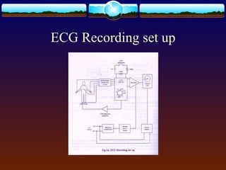 Electrocardiogram Tip Confirmation System.pdf Electrocardiogram | PPT