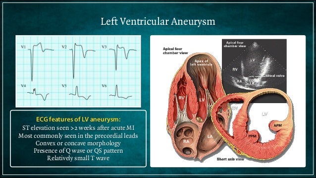 Electrocardiogram