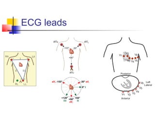ECG leads
 