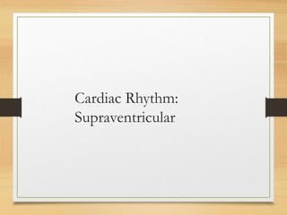 Cardiac Rhythm:
Supraventricular
 