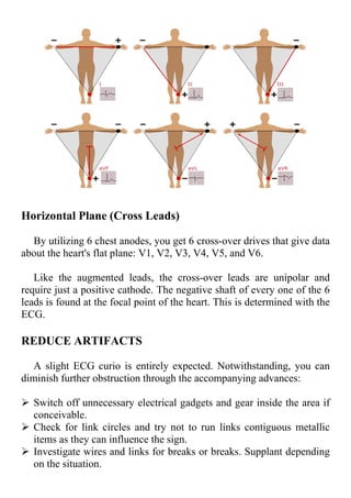 Horizontal Plane (Cross Leads)
By utilizing 6 chest anodes, you get 6 cross-over drives that give data
about the heart's flat plane: V1, V2, V3, V4, V5, and V6.
Like the augmented leads, the cross-over leads are unipolar and
require just a positive cathode. The negative shaft of every one of the 6
leads is found at the focal point of the heart. This is determined with the
ECG.
REDUCE ARTIFACTS
A slight ECG curio is entirely expected. Notwithstanding, you can
diminish further obstruction through the accompanying advances:
 Switch off unnecessary electrical gadgets and gear inside the area if
conceivable.
 Check for link circles and try not to run links contiguous metallic
items as they can influence the sign.
 Investigate wires and links for breaks or breaks. Supplant depending
on the situation.
 