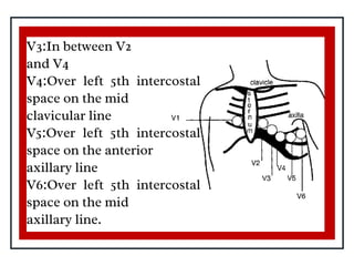 Electrocardiogram_20240614_173859_0000.pdf