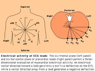 ECG for PT by Padkao T   28
 