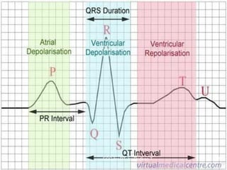 Before we get started
  Verify name, number, date and time.

  Is there an old ECG for comparison?

  Is the paper calibra...