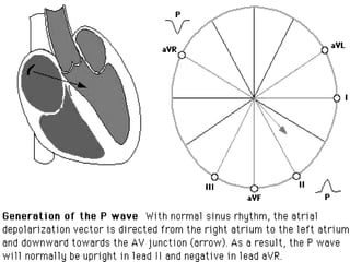 First degree AV block

This is the mildest form of heart block. In this case,
  the electrical signals from the SA node mo...