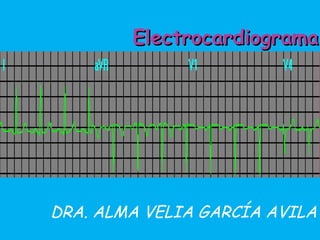 Electrocardiograma DRA. ALMA VELIA GARCÍA AVILA 