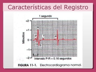 Características del Registro 
