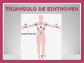 TRIANGULO DE EINTHOVEN 